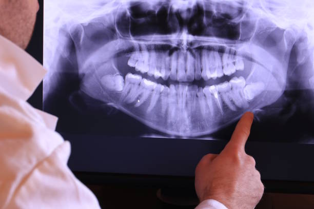 Urgent Tooth Repair in KY